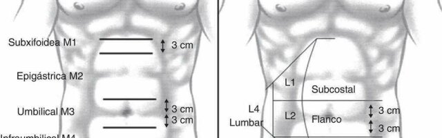 clasificacion-ehs | CLÍNICA de HERNIA ESPECIALIZADA